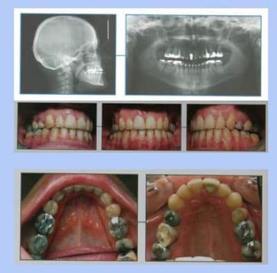 Fin 1 lzh5a6 - Eugenol