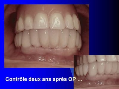 Folie4 q9egfx - Eugenol