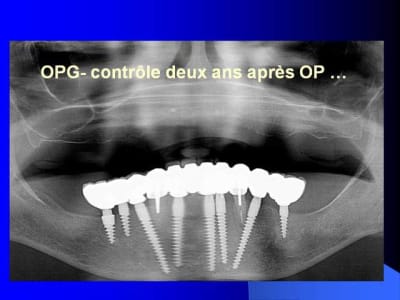 Folie5 icxmia - Eugenol