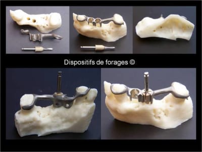 Guide chirurgical 008 tgrlo5 - Eugenol