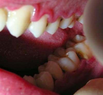 Gun initial2 ysbmxf - Eugenol