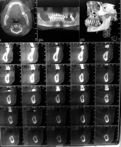 Imag1107 be5kai - Eugenol