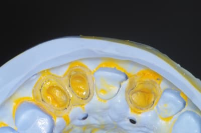 Imgp3943 ft6mt4 - Eugenol