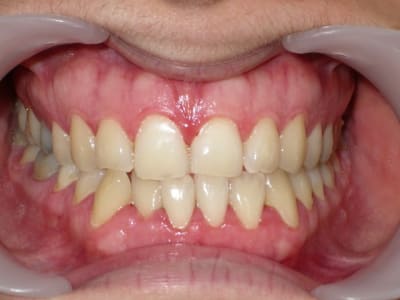 Imgp8145 evjvig - Eugenol