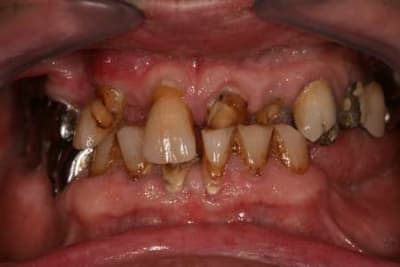 Img 0006 dd5ogx - Eugenol