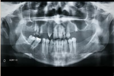 Img 0007 lafxjy - Eugenol