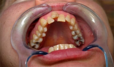 Img 0017 uy0amz - Eugenol