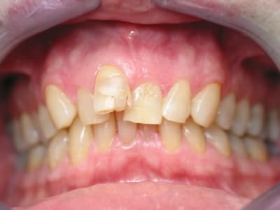 Img 0023 whjkiu - Eugenol