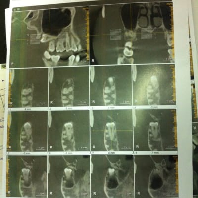 Img 0122 fzuiri - Eugenol