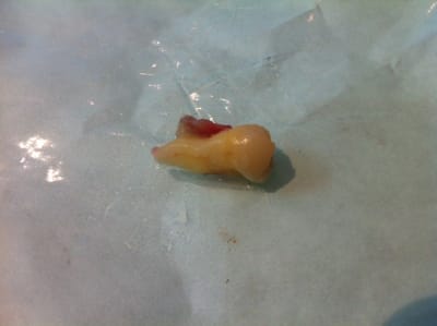 Img 0127 kctp52 - Eugenol