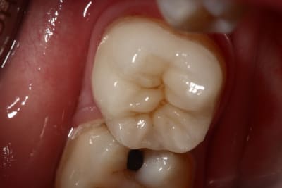 Img 0131 mv5dpw - Eugenol