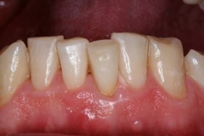 Img 0132 nf7cjm - Eugenol