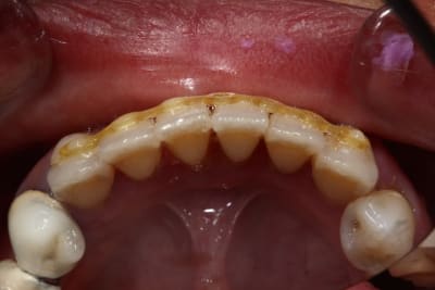 Img 0144 ktgubb - Eugenol