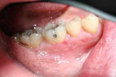 Img 0407 j5gwpw - Eugenol