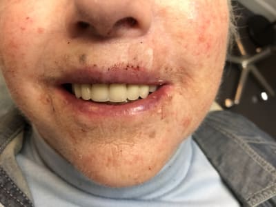 Img 0427 sovyxc - Eugenol