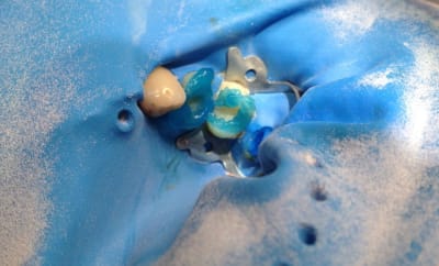 Img 0434 rnu7ea - Eugenol