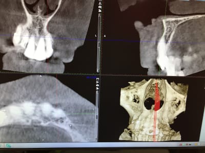 Img 0439 dh0kkm - Eugenol