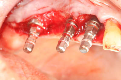 Img 0481 nycfpw - Eugenol