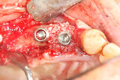 Img 0483 uxegtf - Eugenol