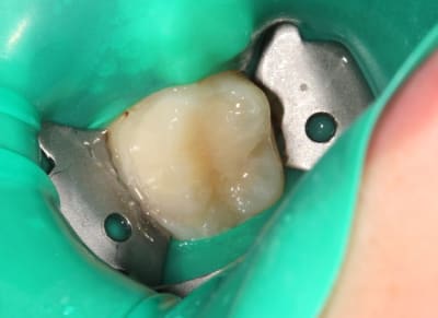 Img 0627 t0yjzp - Eugenol