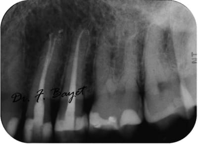 Img 0636 copie kylsbt - Eugenol