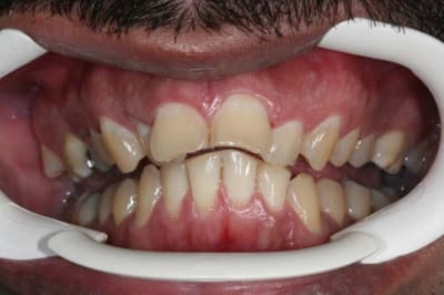 Img 0683 qfh5jk - Eugenol