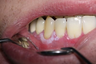 Img 0689 ogd4gj - Eugenol