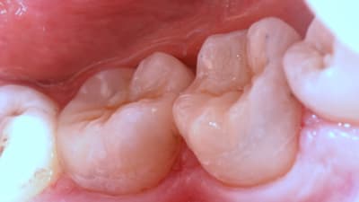 Img 0701 aia0ls - Eugenol
