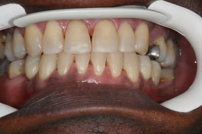 Img 0712 ctynuk - Eugenol