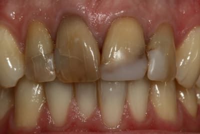 Img 0714 ed8mcp - Eugenol