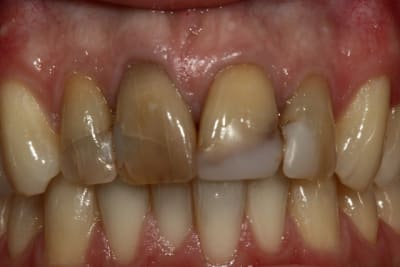 Img 0716 i8ymbv - Eugenol