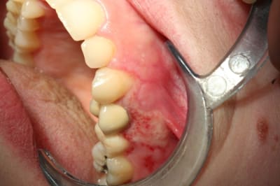 Img 0727 xqdy41 - Eugenol