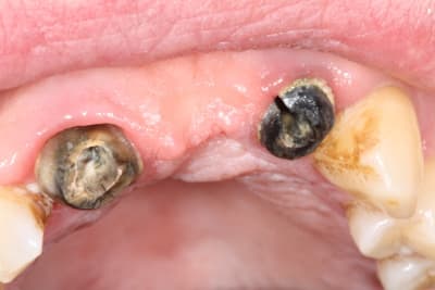 Img 0786 cssnl2 - Eugenol