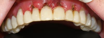 Img 0797c jggbex - Eugenol