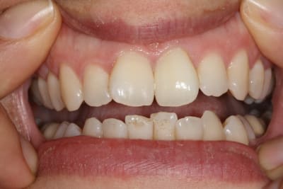 Img 0818 i9y7eo - Eugenol