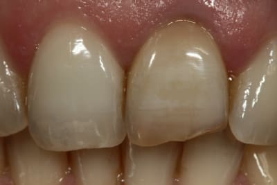 Img 0839 w7rlvt - Eugenol