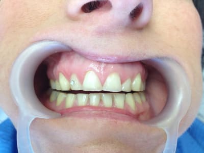 Img 0843 h3nhqy - Eugenol