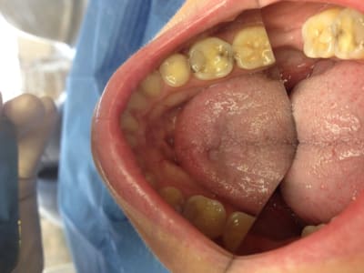 Img 0847 ogpxsl - Eugenol