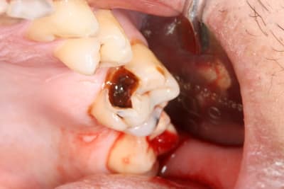 Img 0867 mvyuaw - Eugenol