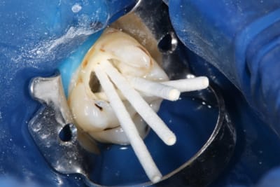 Img 0870 td4qeb - Eugenol