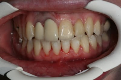 Img 0875 futhno - Eugenol