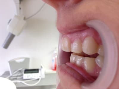 Img 0876 a3dkxl - Eugenol