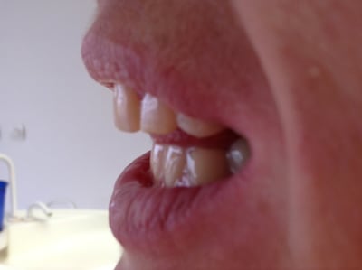 Img 0880 bmiacu - Eugenol