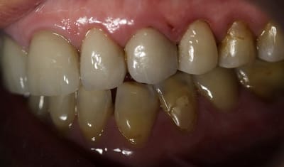 Img 0881   copie t2fglk - Eugenol