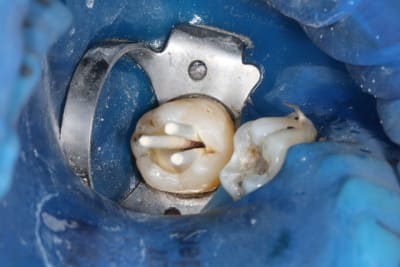 Img 0888 wqgcs9 - Eugenol