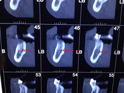 Img 0901 a5z5yi - Eugenol