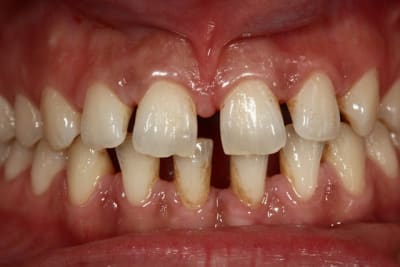 Img 0912 shdlt2 - Eugenol