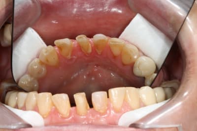 Img 0987 ihmrjt - Eugenol