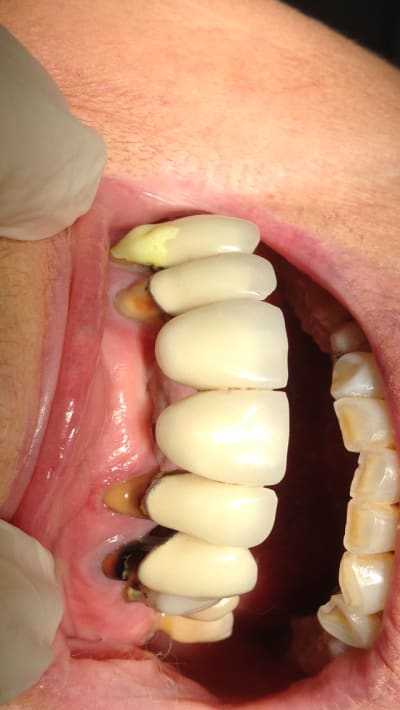 Img 1165 xig8m8 - Eugenol