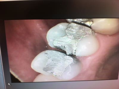 Img 1182 xse8b2 - Eugenol